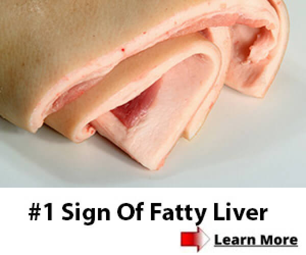 1 Sign Of Fatty Liver, Learn More