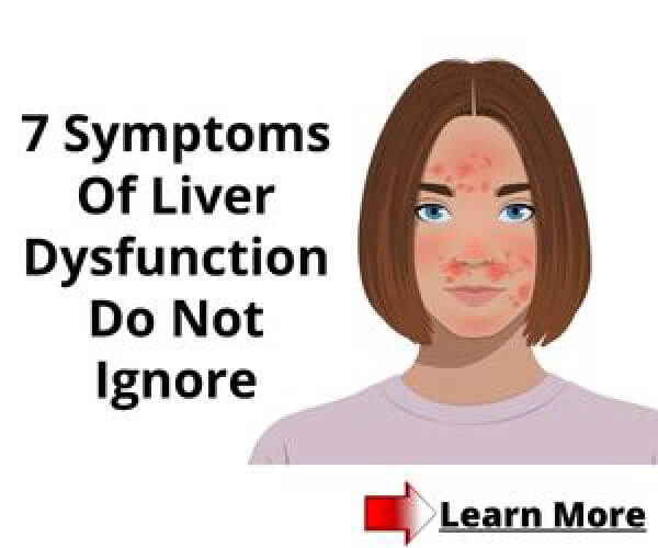 7 Symptoms Of Liver Dysfunction Do Not Ignore, Learn More